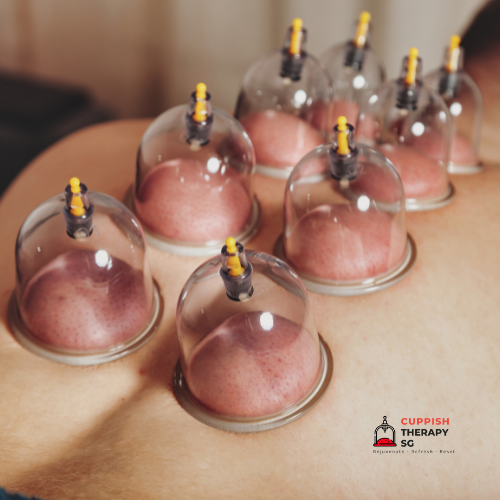 Dry Cupping
